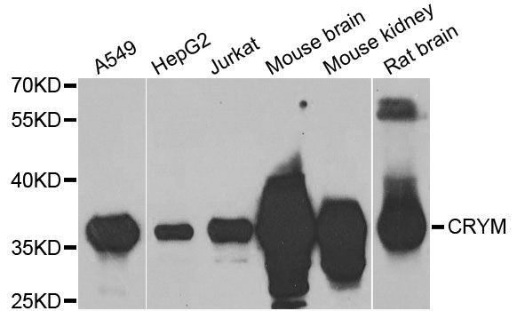 Western blot - CRYM antibody (144-03810)