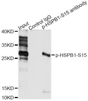 Immunoprecipitation - Phospho-HSPB1-S15 pAb (144-50040)
