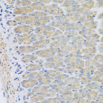 Immunohistochemistry - EFHC1 antibody (144-08002)