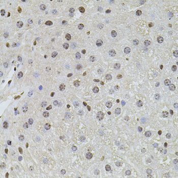 Immunohistochemistry - PLK4 antibody (144-09863)