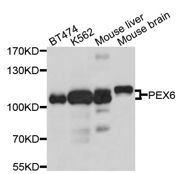 Western blot - PEX6 Polyclonal Antibody (144-10459)