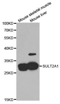 Western blot - SULT2A1 antibody (144-05489)