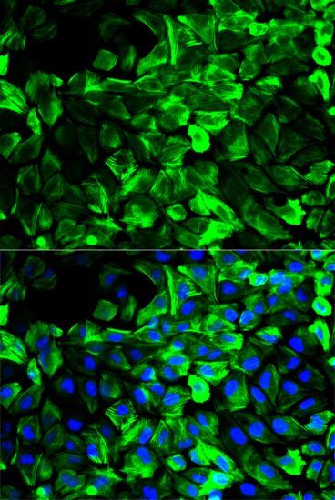 Immunofluorescence - TPM1 antibody (144-01157)