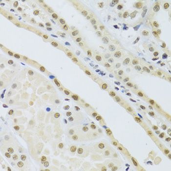 Immunohistochemistry - DDB1 Polyclonal Antibody (144-02896)