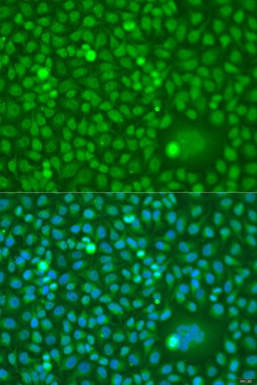 Immunofluorescence - CDK10 antibody (144-02690)