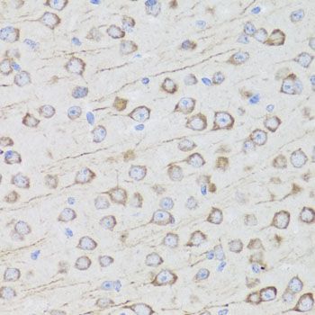Immunohistochemistry - MIP antibody (144-02886)