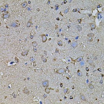 Immunohistochemistry - FDX1 antibody (144-09815)