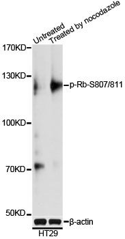 Western blot - Phospho-Rb-S807/811 pAb (144-61498)