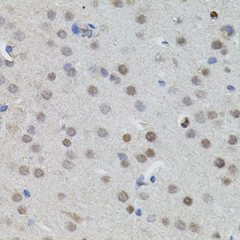Immunohistochemistry - MYCN Polyclonal Antibody (144-00499)