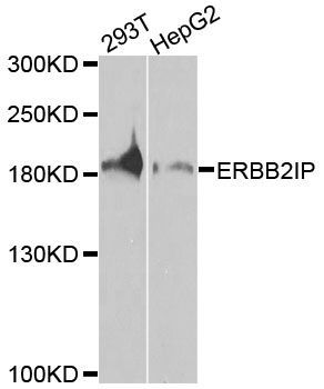 Western blot - ERBB2IP antibody (144-08585)