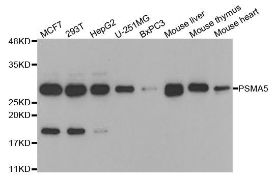 Western blot - PSMA5 Polyclonal Antibody (144-05752)