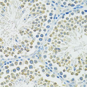 Immunohistochemistry - SLC1A4 antibody (144-12507)