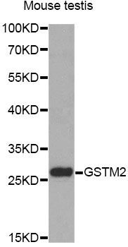Western blot - GSTM2 antibody (144-60360)