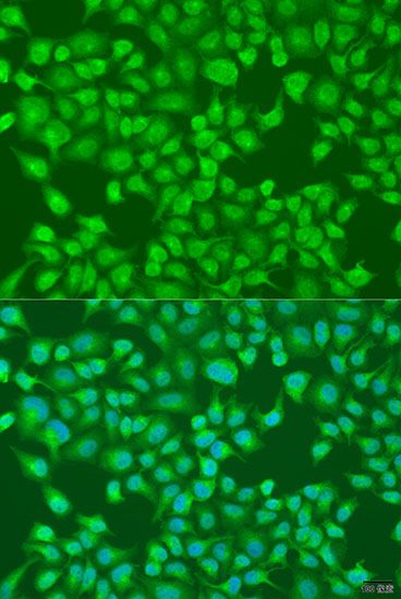 Immunofluorescence - ACOX1 antibody (144-08091)