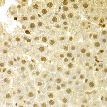 Immunohistochemistry - SFN Polyclonal Antibody (144-01026)