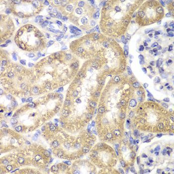 Immunohistochemistry - HADH Polyclonal Antibody (144-01076)