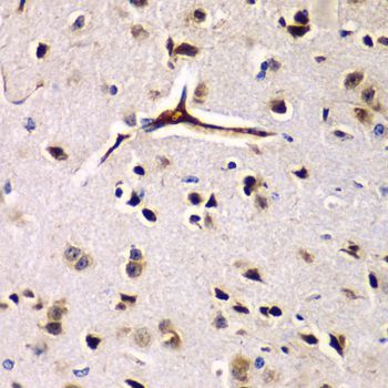 Immunohistochemistry - EIF2AK4 antibody (144-07155)