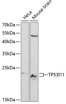 Western blot