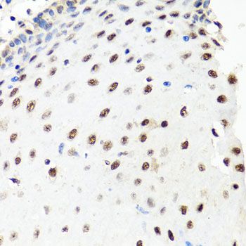 Immunohistochemistry - PRPF8 Polyclonal Antibody (144-06053)
