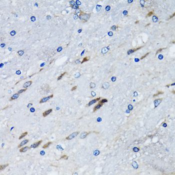 Immunohistochemistry - BLZF1 Polyclonal Antibody (144-06430)