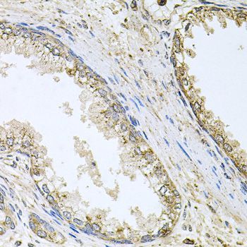 Immunohistochemistry - CYP46A1 Polyclonal Antibody (144-08573)