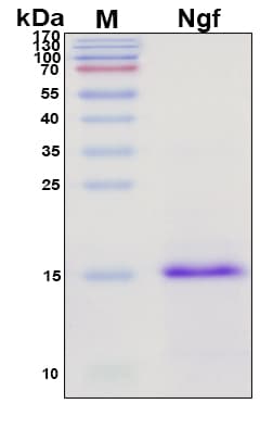 SDS-PAGE Image