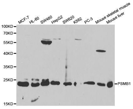 Western blot - PSMB1 Polyclonal Antibody (144-01043)