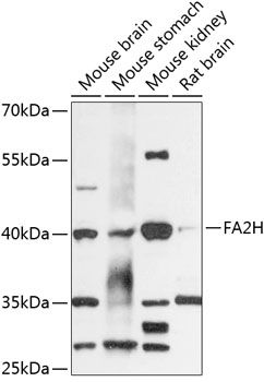 Western blot