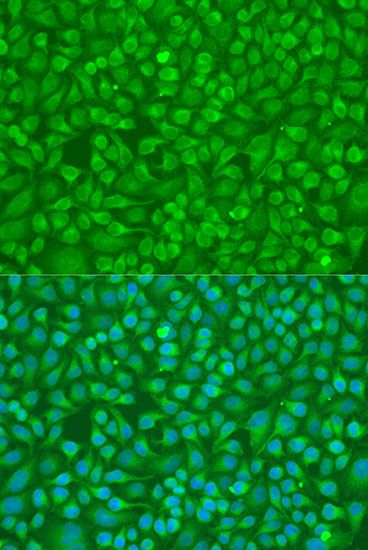 Immunofluorescence - MMP8 antibody (144-01963)