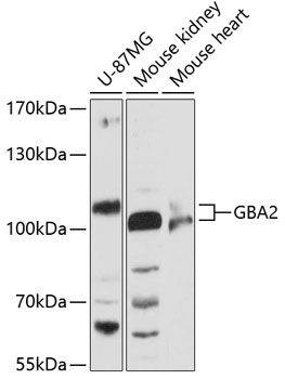 Western blot