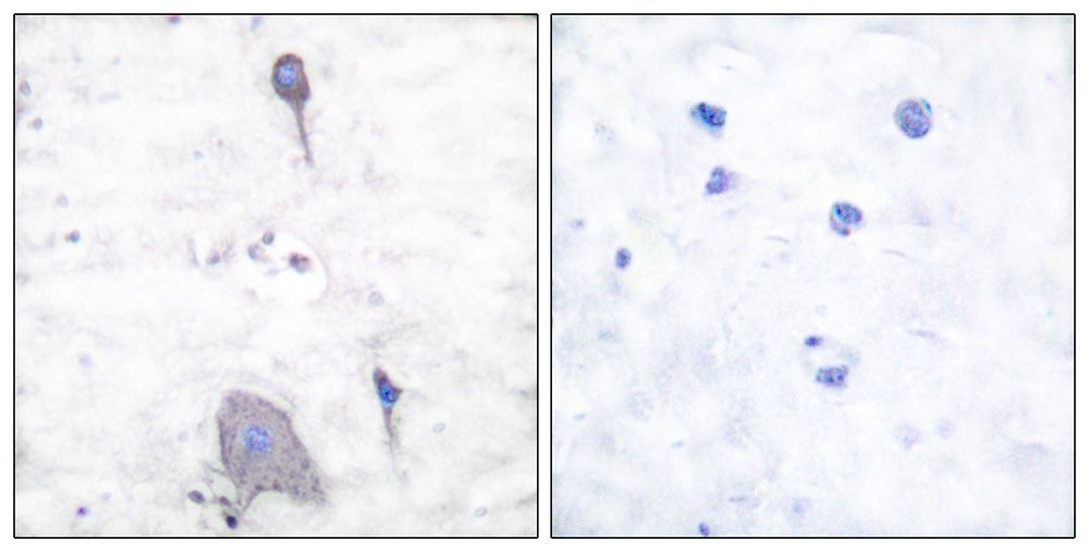IHC