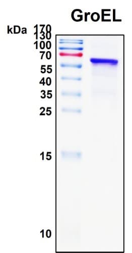 SDS-PAGE Image