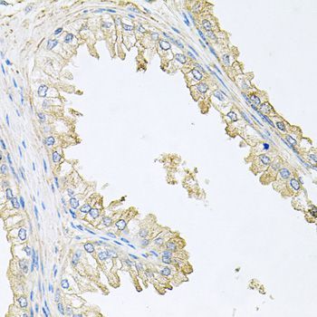 Western blot - PPP3R1 Polyclonal Antibody (144-00954)