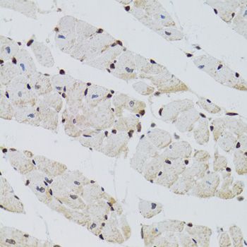 Immunohistochemistry - CTCF Polyclonal Antibody (144-60257)