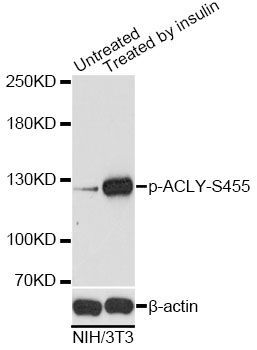 Western blot - Phospho-ACLY-S455 pAb (144-61516)