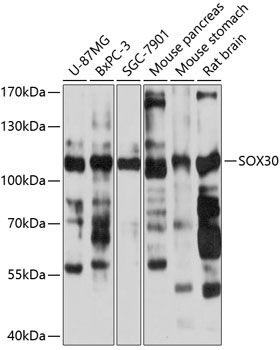 Western blot