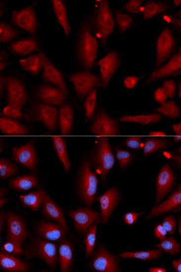 Immunofluorescence - WIF1 Polyclonal Antibody (144-05386)