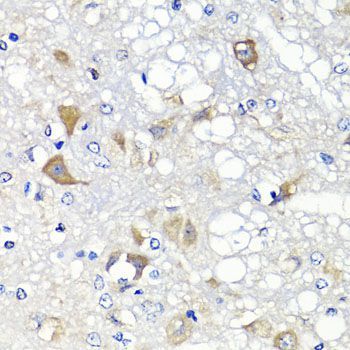 Immunohistochemistry - PSPH antibody (144-07924)