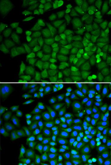 Immunohistochemistry - [KO Validated] SELENBP1 Polyclonal Antibody (144-01222)