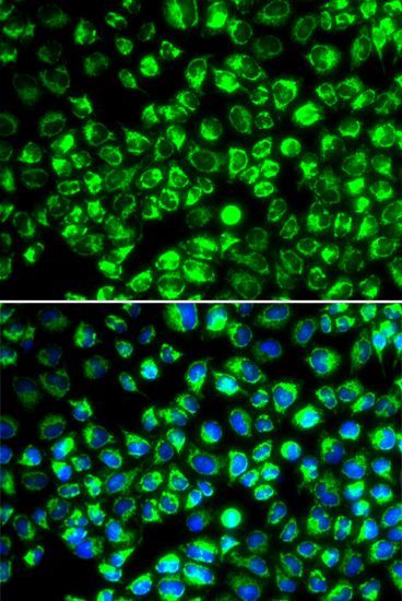 Immunofluorescence - ATP6AP2 antibody (144-06531)