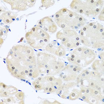 Immunohistochemistry - DNAL1 antibody (144-08267)