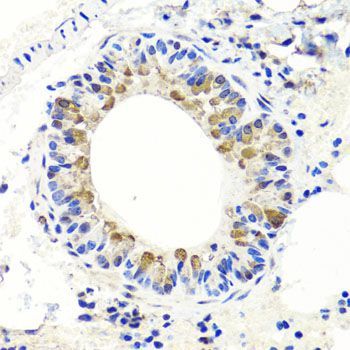 Immunohistochemistry - ENDOG Polyclonal Antibody (144-00604)