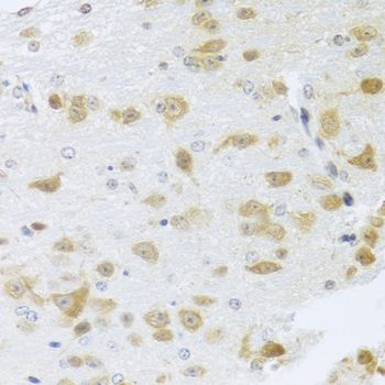 Immunohistochemistry - Gm13125 antibody (144-08095)