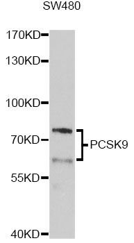 Western blot - PCSK9 Antibody (144-07860)