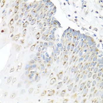 Immunohistochemistry - STAU1 antibody (144-04131)