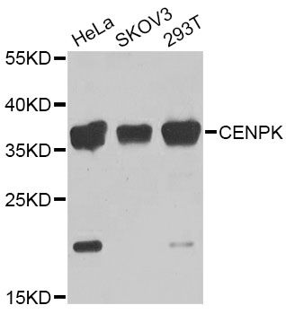 Western blot - CENPK Antibody (144-07627)