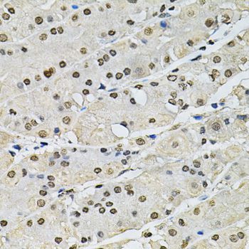 Immunohistochemistry - H2AFZ antibody (144-06614)