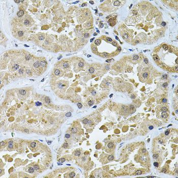 Immunohistochemistry - GALNT2 Antibody (144-06910)