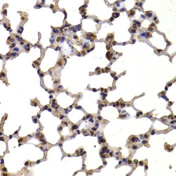 Western blot - TXN Polyclonal Antibody (144-07638)