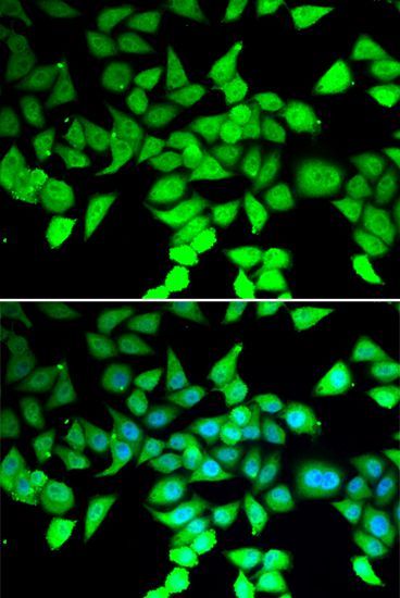 Immunofluorescence - HDAC7 antibody (144-07285)